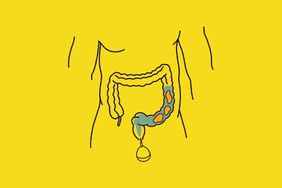 Illustration of intestines and an enema