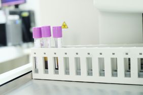 biological sample tube in the lab of hematology