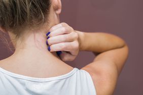 psoriasis flares triggers causes