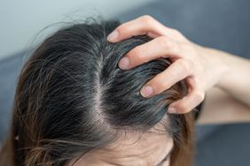 A woman itches her scalp