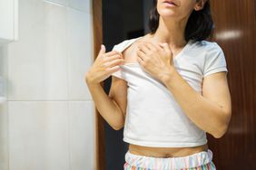Middle-aged woman seeing the effect of psoriasis on her chest