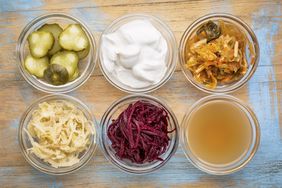 A set of fermented foods that are high in probiotics and prebiotics.
