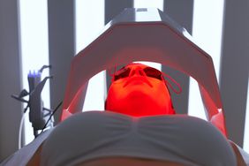 A woman undergoing red light therapy in the face