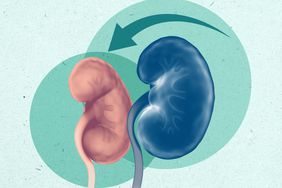 reverse kidney disease , Kidneys Anatomy