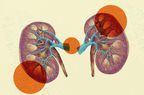 What-Are-the-Signs-of-Kidney-Disease-GettyImages-623682045